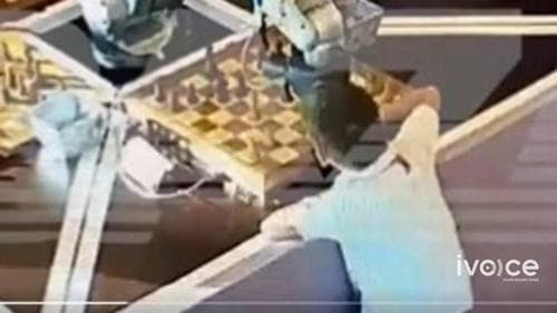 Шатар тоглодог робот долоон настай хүүгийн хурууг хугалжээ