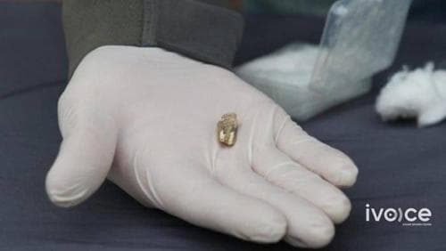 Археологичид 1.8 сая жилийн настай хүний шүдийг олж илрүүлжээ