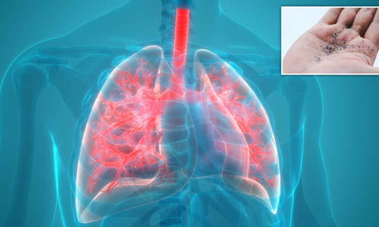 Хүний уушгинаас анхны удаа микропластик илэрчээ